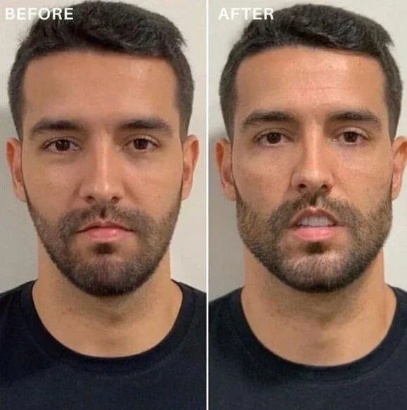 Jawline Trainer Kit